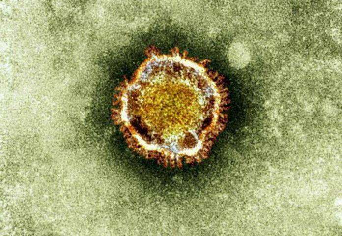 This undated file image released by the British Health Protection Agency shows an electron microscope image of a coronavirus, part of a family of viruses that cause ailments including the common cold and SARS, which was first identified in the Middle East. HANDOUT/THE ASSOCIATED PRESS