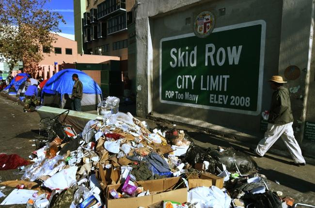 Leprosy Could Be The Next Public Health Crisis To Hit Los Angeles